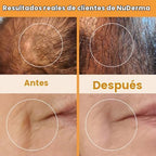 Pure Daily Care NuDerma Varita Manual para Terapia de la Piel con N...