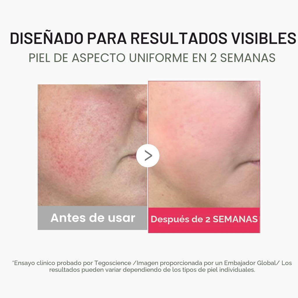 medicube Booster Pro Mini Plus - Dispositivo facial portátil para |...