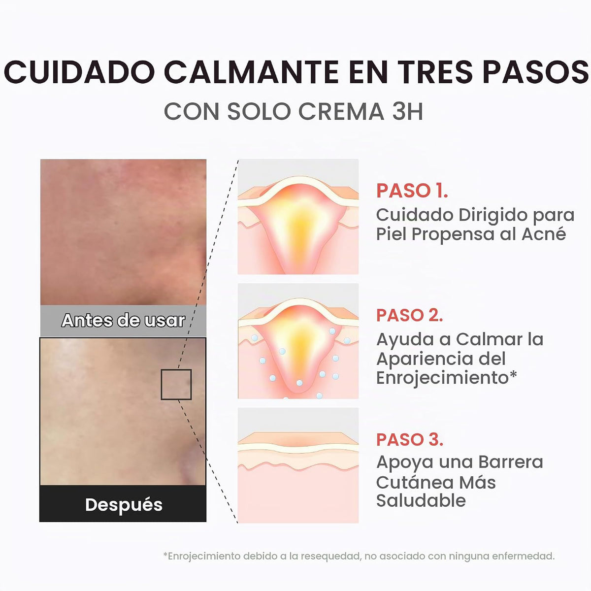 medicube Crema de alivio diario 3H para todo tipo de piel y cuidado...